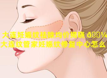 大连妊娠纹祛除均价揭晓 🐼 「大连纹管家妊娠纹修复中心怎么 🐟 样」